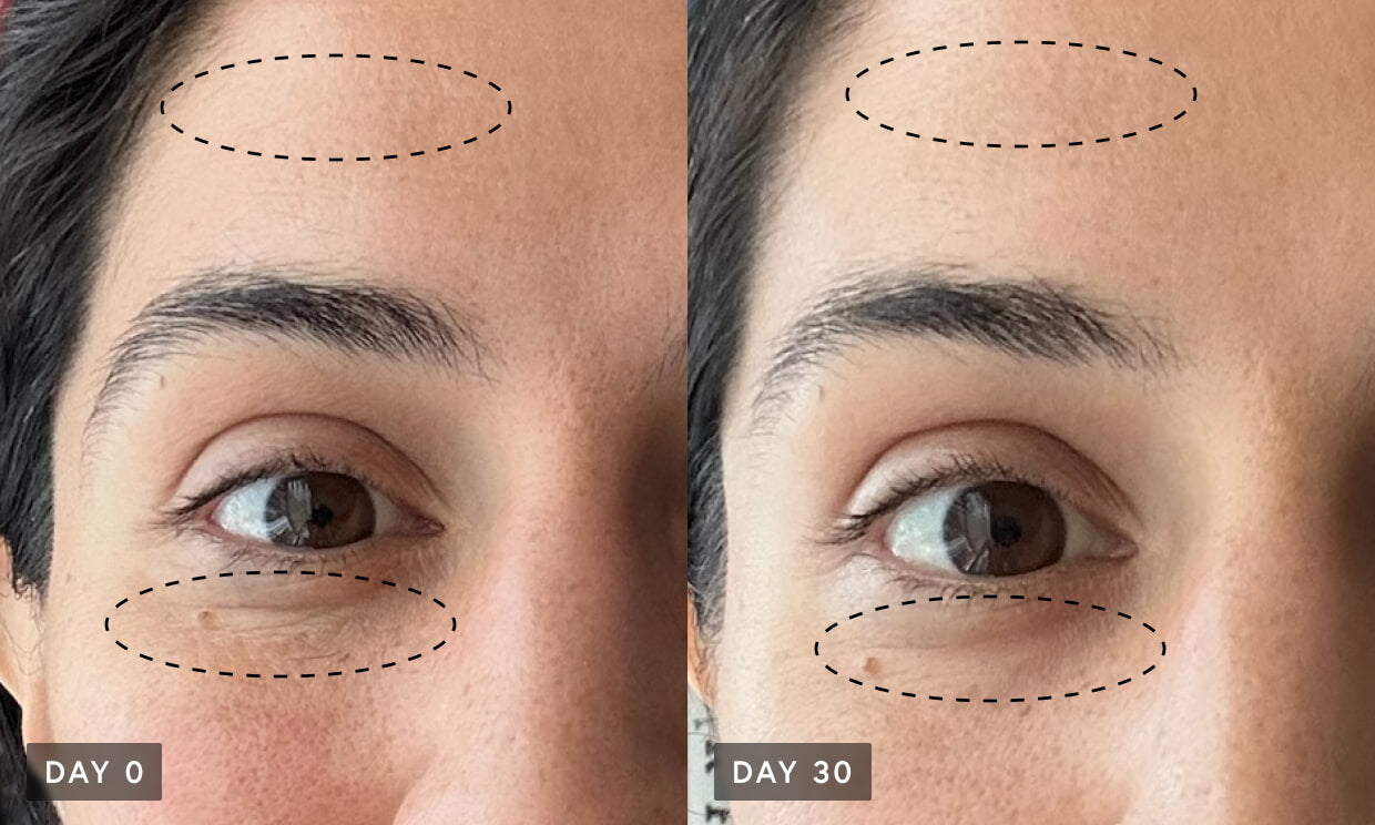 Close-up on forehead and undereye, before and after