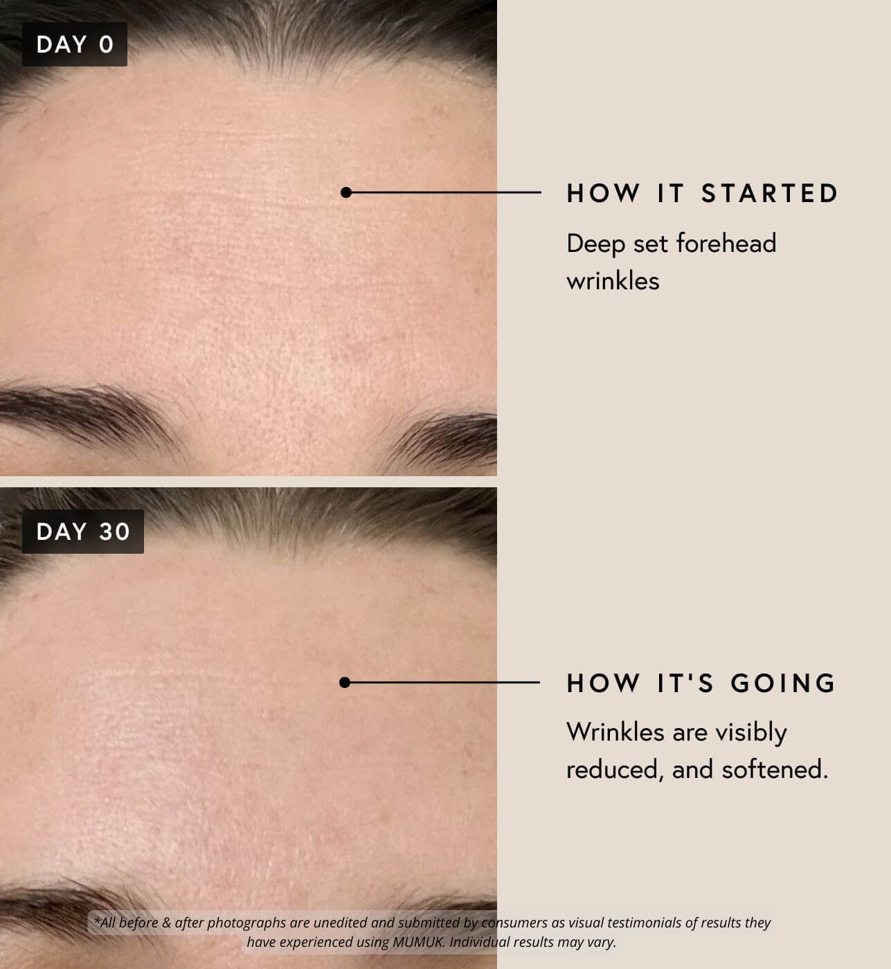 Growth Factor (EGF) Regenerative Serum | MUMUK Skincare