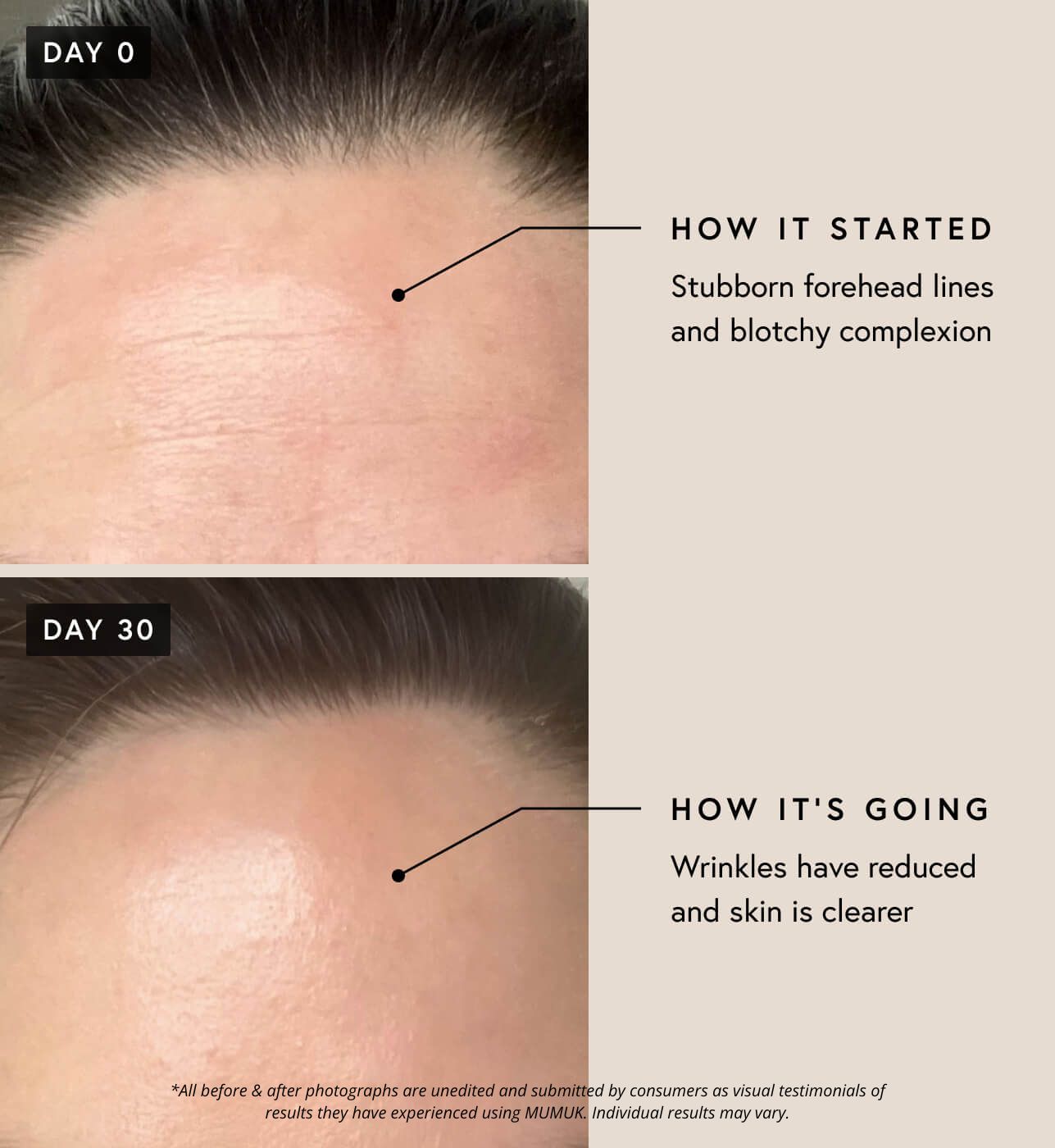 Regenerative Complex